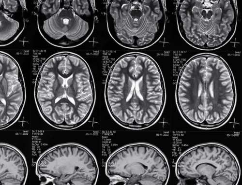 Is Traumatic Brain Injury Considered a Disability?